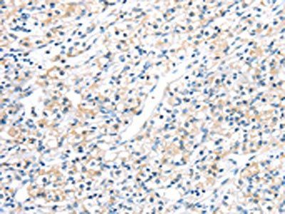 HSD11B2 Antibody