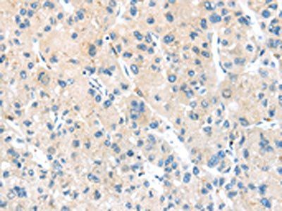 HSD11B2 antibody