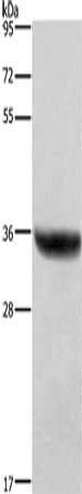 HSD17B1 Antibody