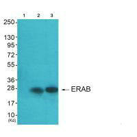 HSD17B10 antibody