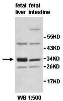 HSD17B11 antibody