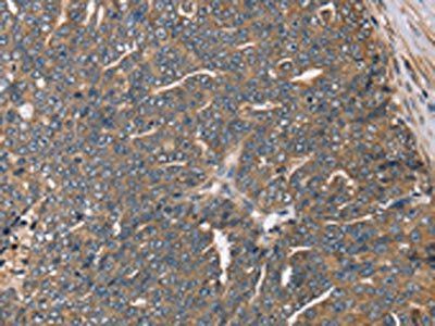 HSD17B12 Antibody