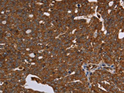 HSD17B13 Antibody