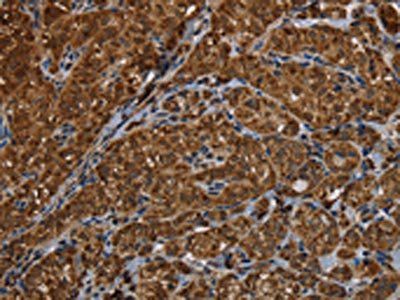 HSD17B13 Antibody