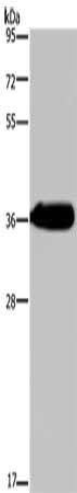 HSD17B13 Antibody