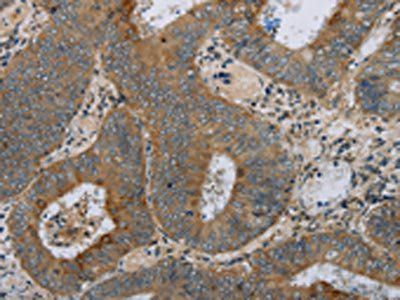 HSD17B14 Antibody