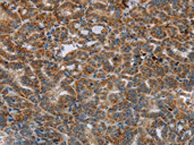 HSD17B14 Antibody
