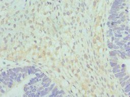 HSD17B2 Antibody