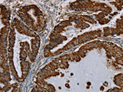 HSD17B2 Antibody