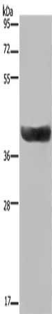 HSD17B2 antibody