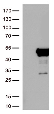 HSD17B3 Antibody