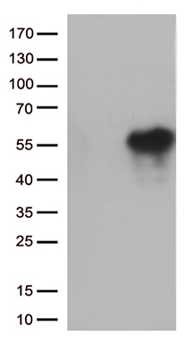 HSD17B3 Antibody