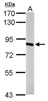 hydroxysteroid 17-beta dehydrogenase 4 Antibody