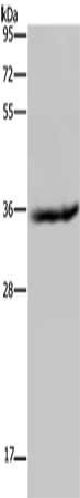 HSD17B6 antibody