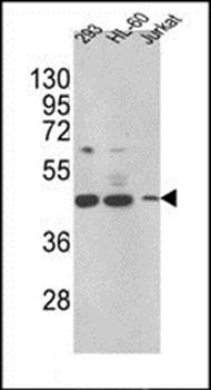 HSD17B7 antibody