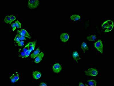 HSD17B7 antibody