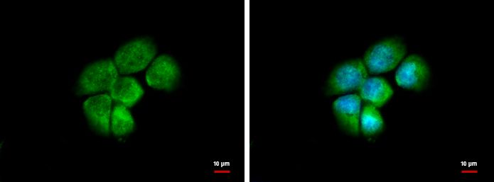 HSD3a Rabbit Polyclonal Antibody