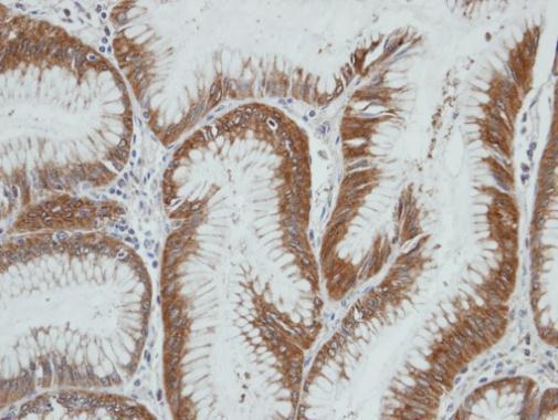 HSD3a Rabbit Polyclonal Antibody