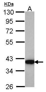 HSD3a Rabbit Polyclonal Antibody