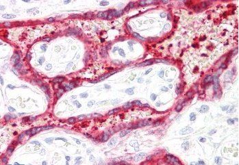 Goat anti-HSD3B1 Antibody