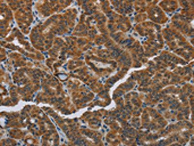 HSD3B7 Antibody