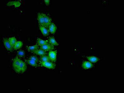 HSD3B7 Antibody