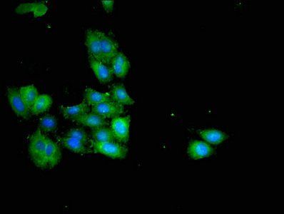 HSD3B7 antibody