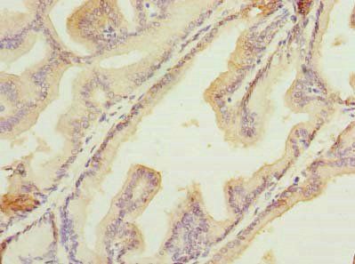HSDL2 Antibody
