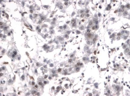 Rabbit Human HSF-1 Antibody
