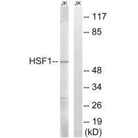 HSF1 (Ab-121) antibody