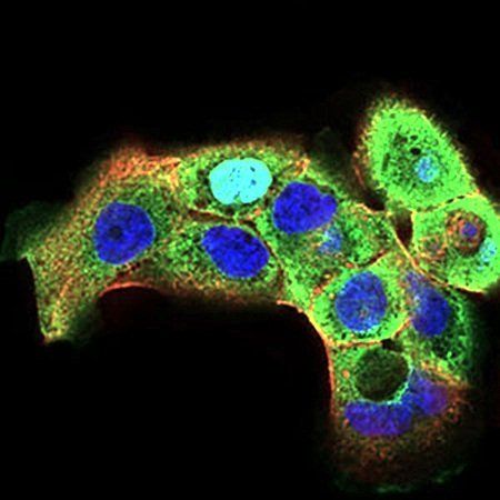 HSF1 Antibody