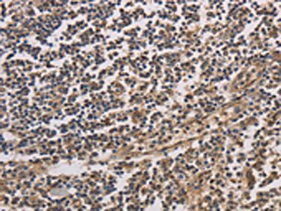 HSF1 Antibody