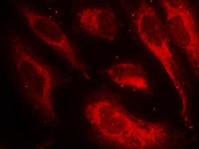 HSF1 (Phospho-Ser307) Antibody