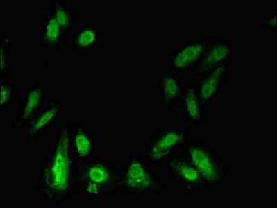 HSL antibody