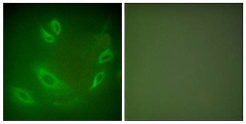 HSP105 Antibody