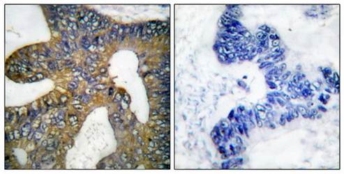 HSP105 Antibody