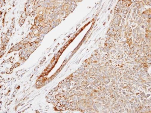 HSP22 Rabbit Polyclonal Antibody