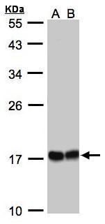 HSP22 Rabbit Polyclonal Antibody