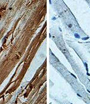 HSP22 Rabbit Polyclonal Antibody