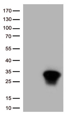HSPB1 Antibody