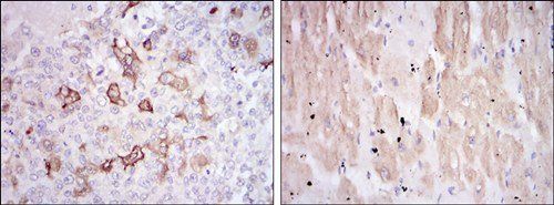 HSP27 Antibody