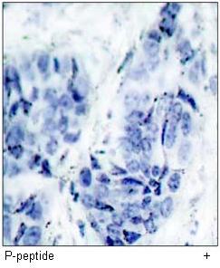 HSP27 (Phospho-Ser15) Antibody