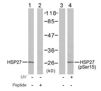 HSP27 (Phospho-Ser15) Antibody