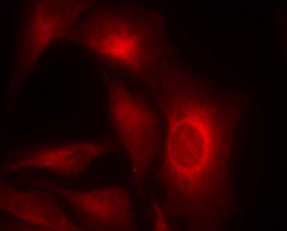 HSP27 (Phospho-Ser15) Antibody