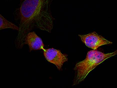 HSP27 (Phospho-Ser78) Antibody