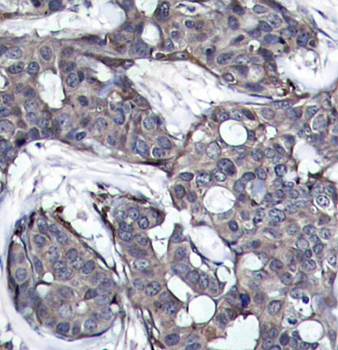 HSP27 (Phospho-Ser82) Antibody