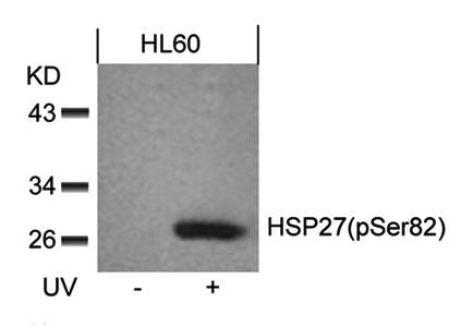 HSP27 (Phospho-Ser82) Antibody