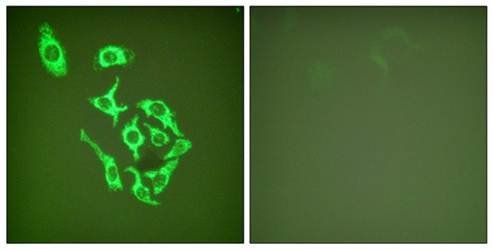 HSP60 Antibody