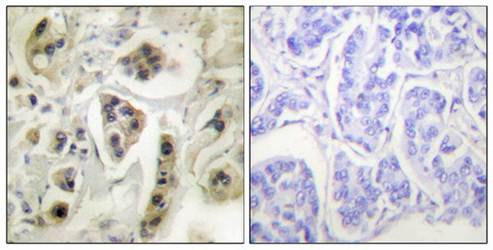 HSP60 Antibody