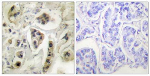 HSP60 antibody